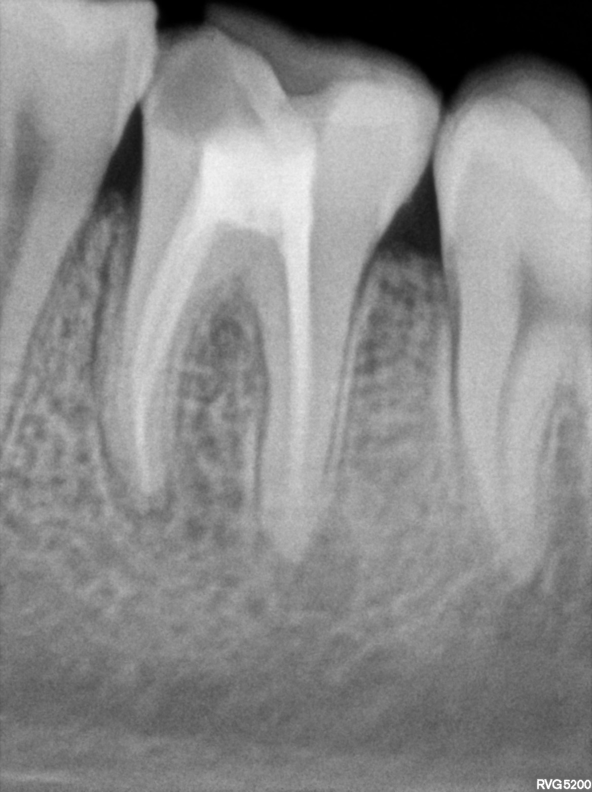 Dental X-ray